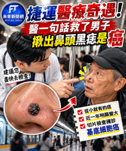 捷運奇遇救一命！皮膚科醫師一句提醒　60歲男鼻頭黑痣切片竟是皮膚癌